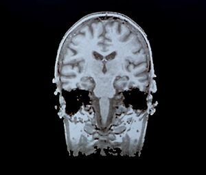 Sex video Kate Winslet nude - Iris (2001)