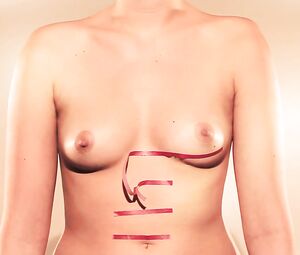 Vincha - Les pβtits seins